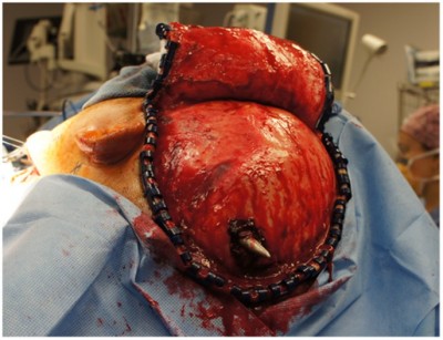 speargun-suicide-04.jpg (90.22KiB)Przejrzano 98405 razy speargun-suicide-04.jpg