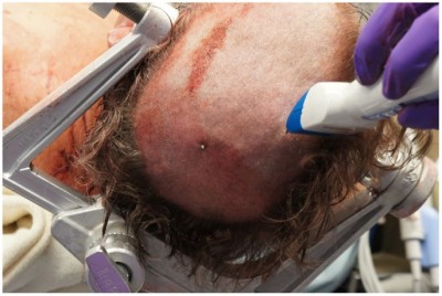 speargun-suicide-03.jpg (80.8KiB)Przejrzano 115856 razy speargun-suicide-03.jpg