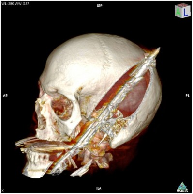 speargun-suicide-01.jpg (72.65KiB)Przejrzano 84417 razy speargun-suicide-01.jpg