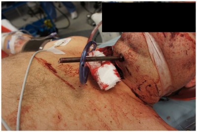 speargun-suicide-02.jpg (73.25KiB)Przejrzano 115927 razy speargun-suicide-02.jpg