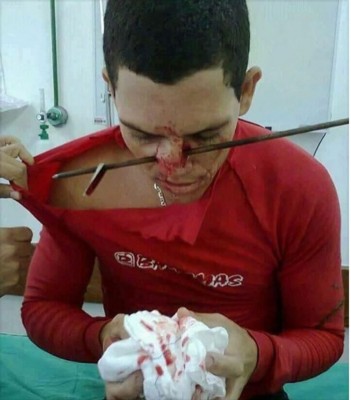 Nose shot.jpg (169.39KiB)Przejrzano 84300 razy Nose shot.jpg