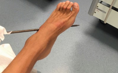 Freediving accident Federico Mana.jpg (190.11KiB)Przejrzano 84300 razy Freediving accident Federico Mana.jpg